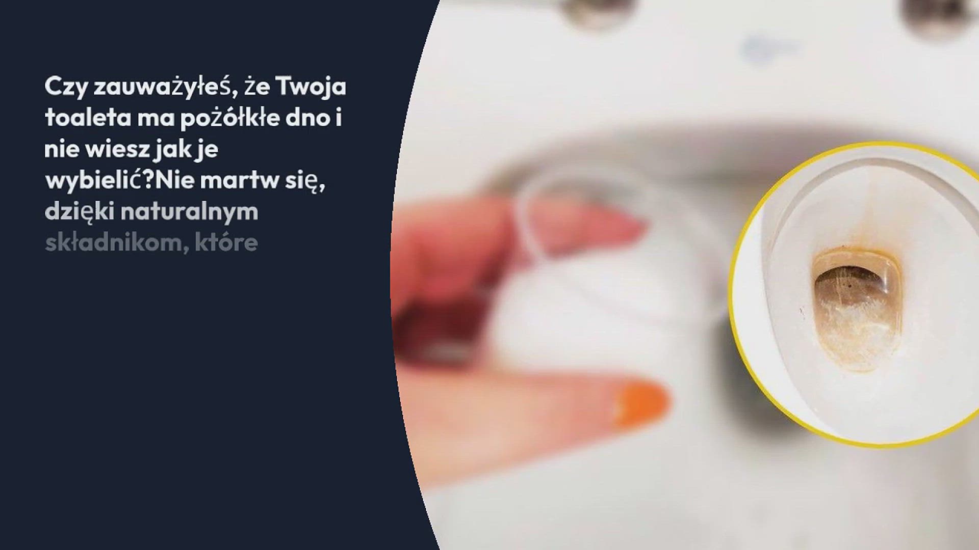 Video thumbnail for Pożółkłe dno toalety biegnij do kuchni i natychmiast się go pozbądź: wystarczy jedna kropla
