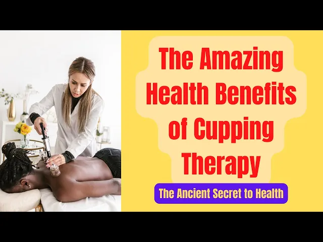 Video thumbnail for Cupping Therapy Benefits for Health