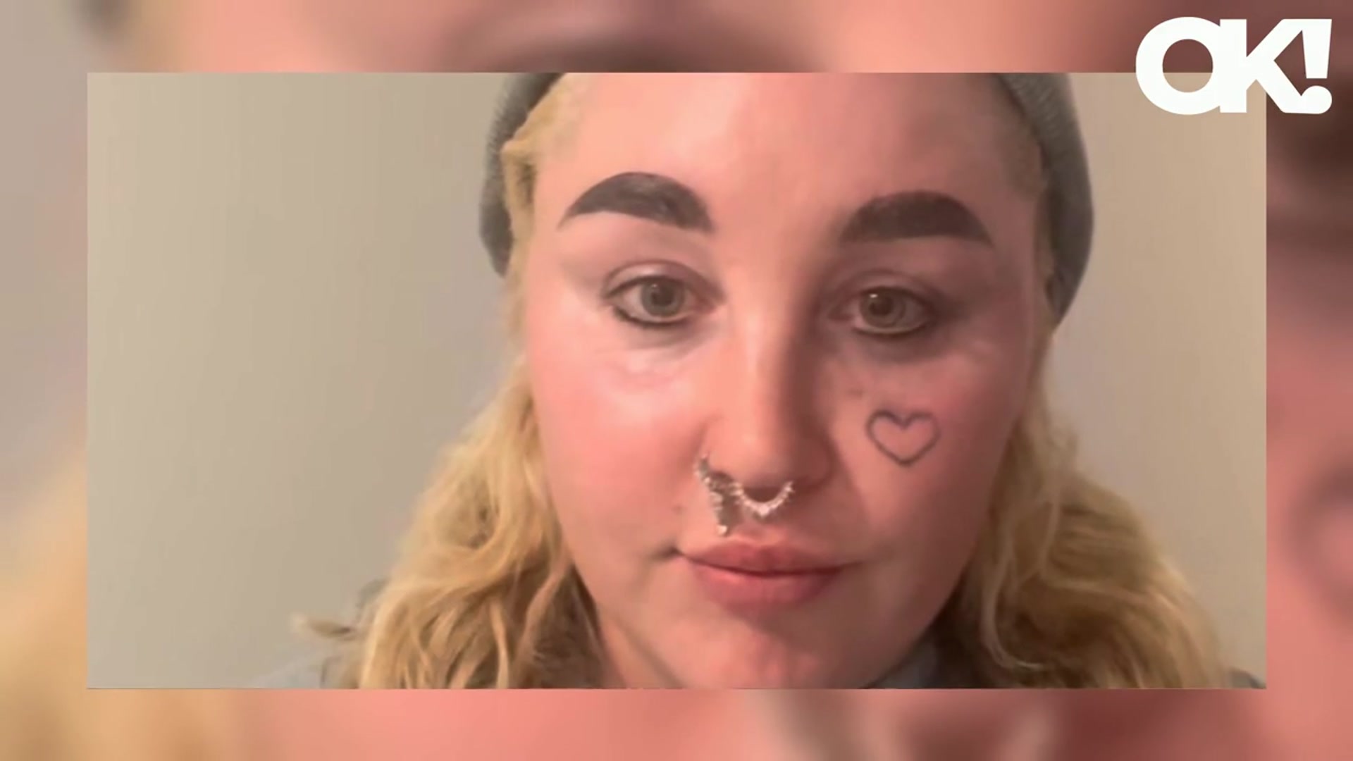 'Video thumbnail for Troubled Amanda Bynes Trades in Tooth Gems for New Grillz: 'It's Pretty Awesome''
