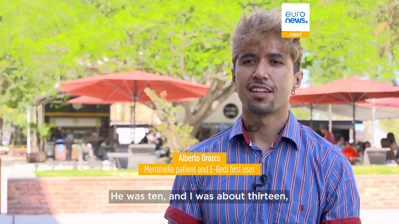 Video thumbnail for Mexican researchers develop simplified robotic arm inspired by a simple childhood promise