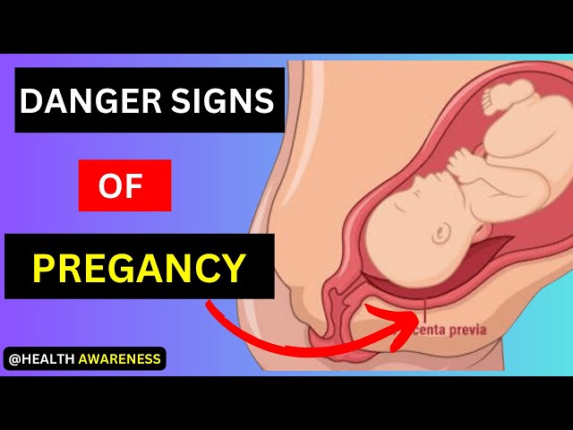 Video thumbnail for 18 Danger Signs Not To Ignore In Early And Late Pregnancy