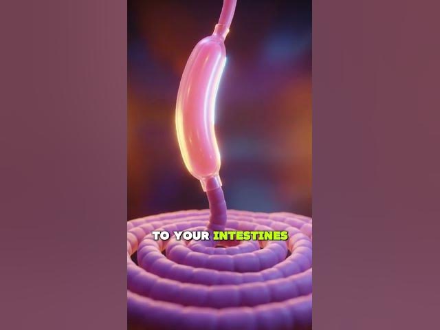 Video thumbnail for How Stomach Stapling Actually Works (explained)