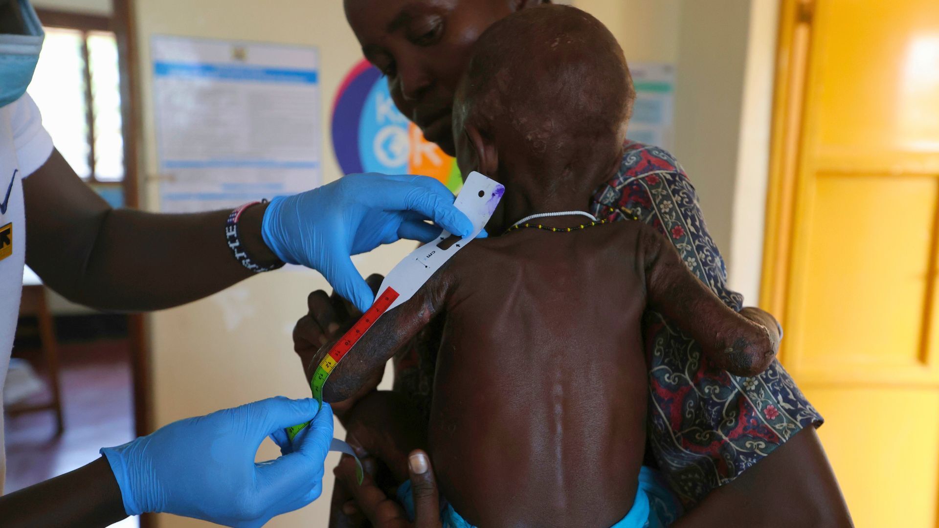 'Video thumbnail for Kenya refugee children face starvation as aid cuts halt life-saving food supplies'
