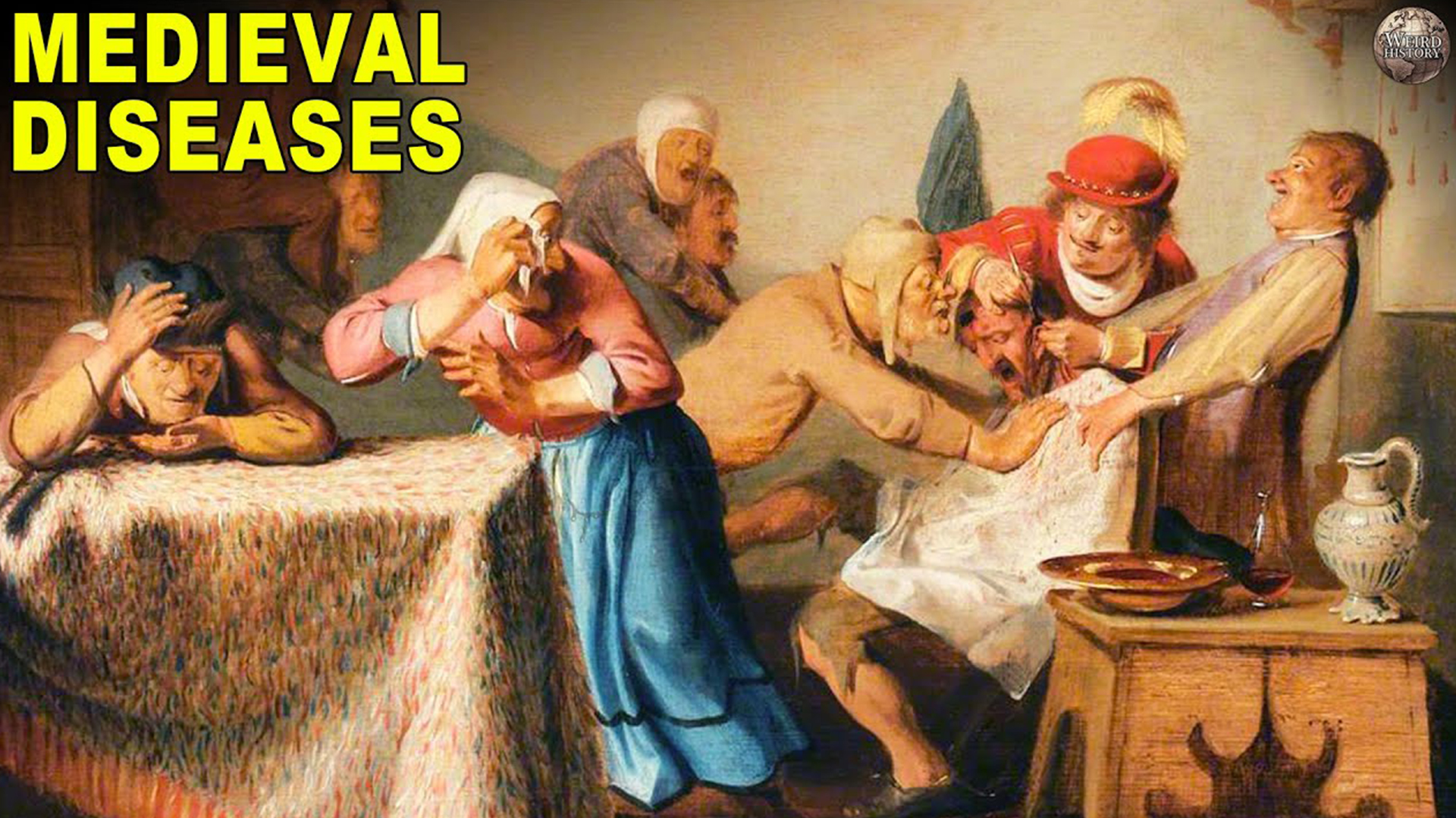 Video thumbnail for All The Afflictions You Might Have If You Lived In A Medieval City