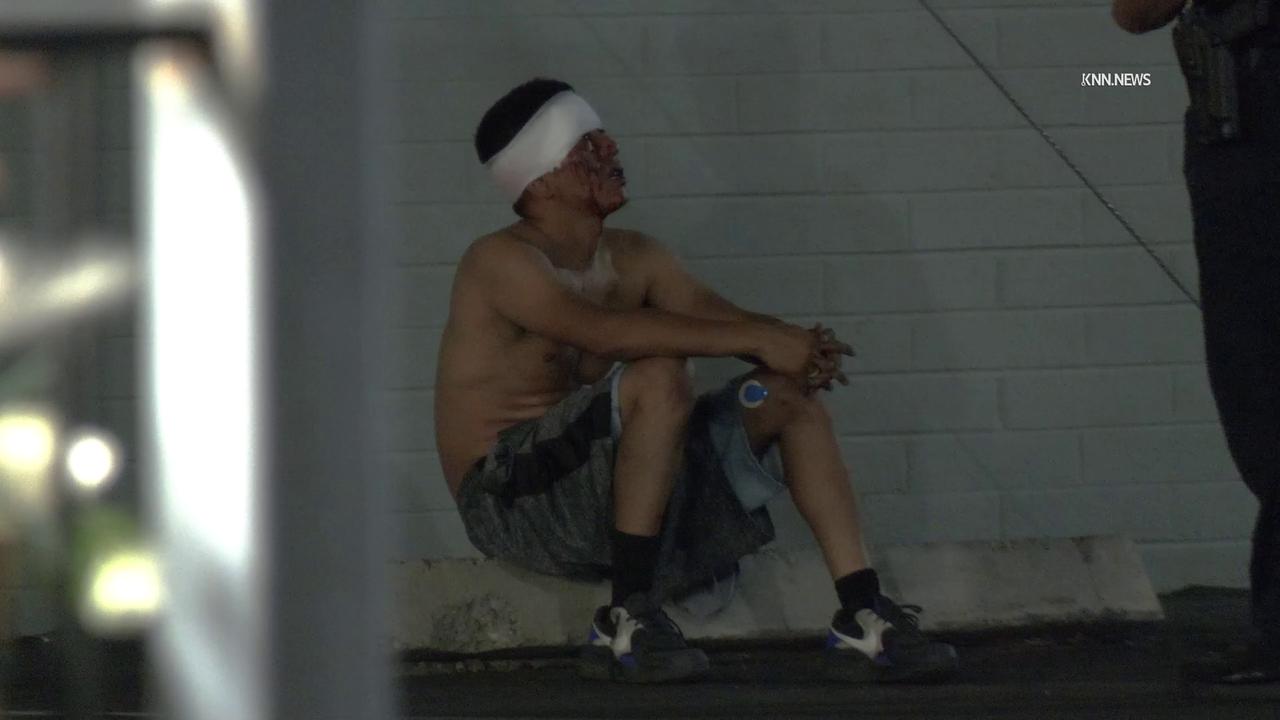 Video thumbnail for US, Phoenix: Mesa Man Injured After Reported Assault With Rock.