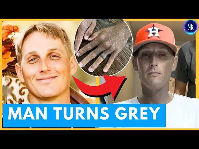 Video thumbnail for Louisiana Man's Skin Changed Color Overnight