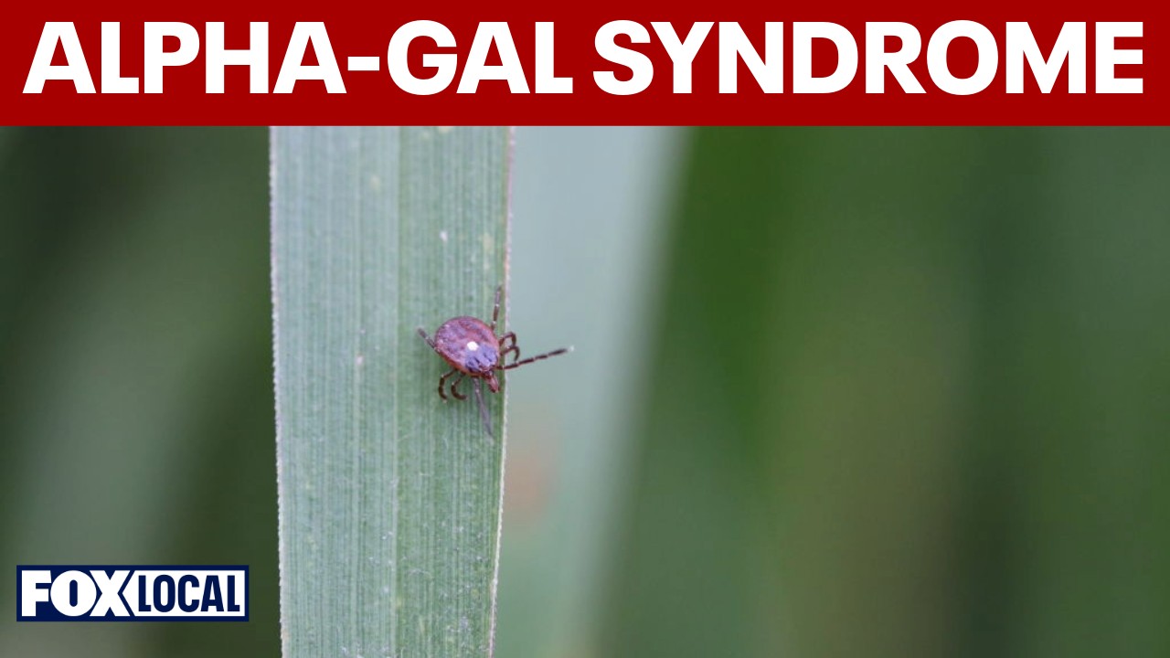 Video thumbnail for Alpha-gal syndrome cases rise on Long Island after Lone Star tick bites