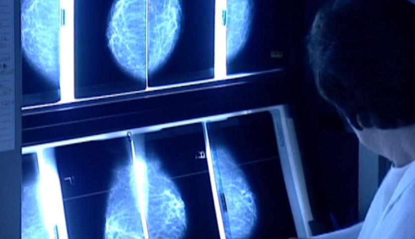 Video thumbnail for Young women can get breast cancer too, making early awareness critical