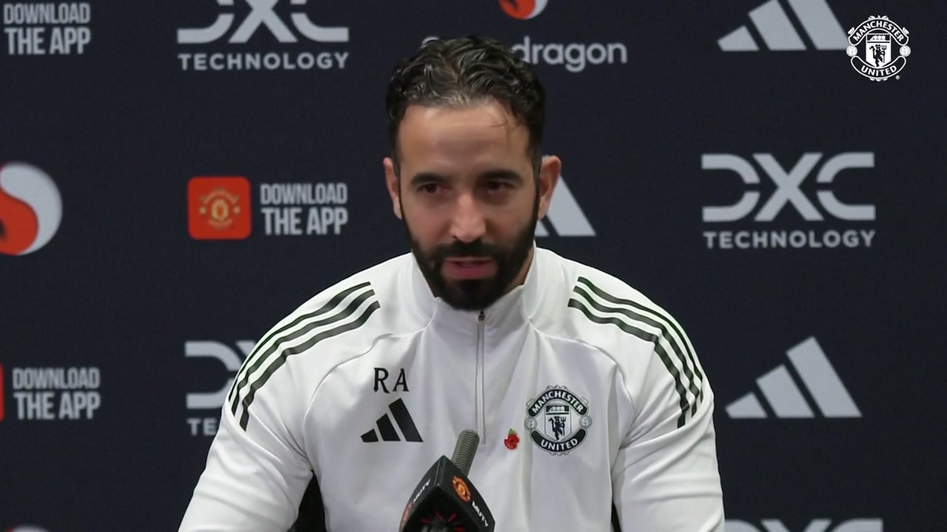 'Video thumbnail for Amorim backs Sesko to get over initial struggles'