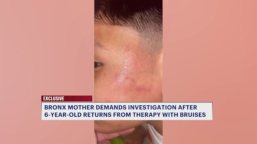 Video thumbnail for Bronx mother demands investigation after 6-year-old returns from therapy with bruises