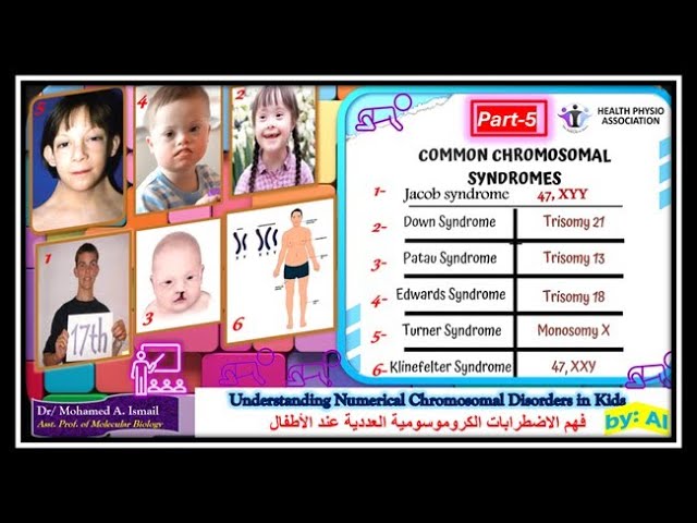 Video thumbnail for Understanding Numerical Chromosomal Disorders in Kidsفهم الاضطرابات الكروموسومية العددية عند الأطفال