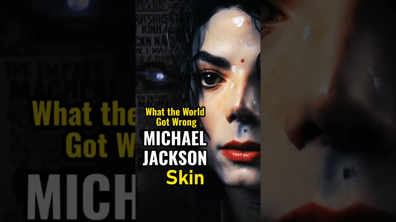 Video thumbnail for The Untold Truth About Michael Jackson’s Skin | Vitiligo Revealed