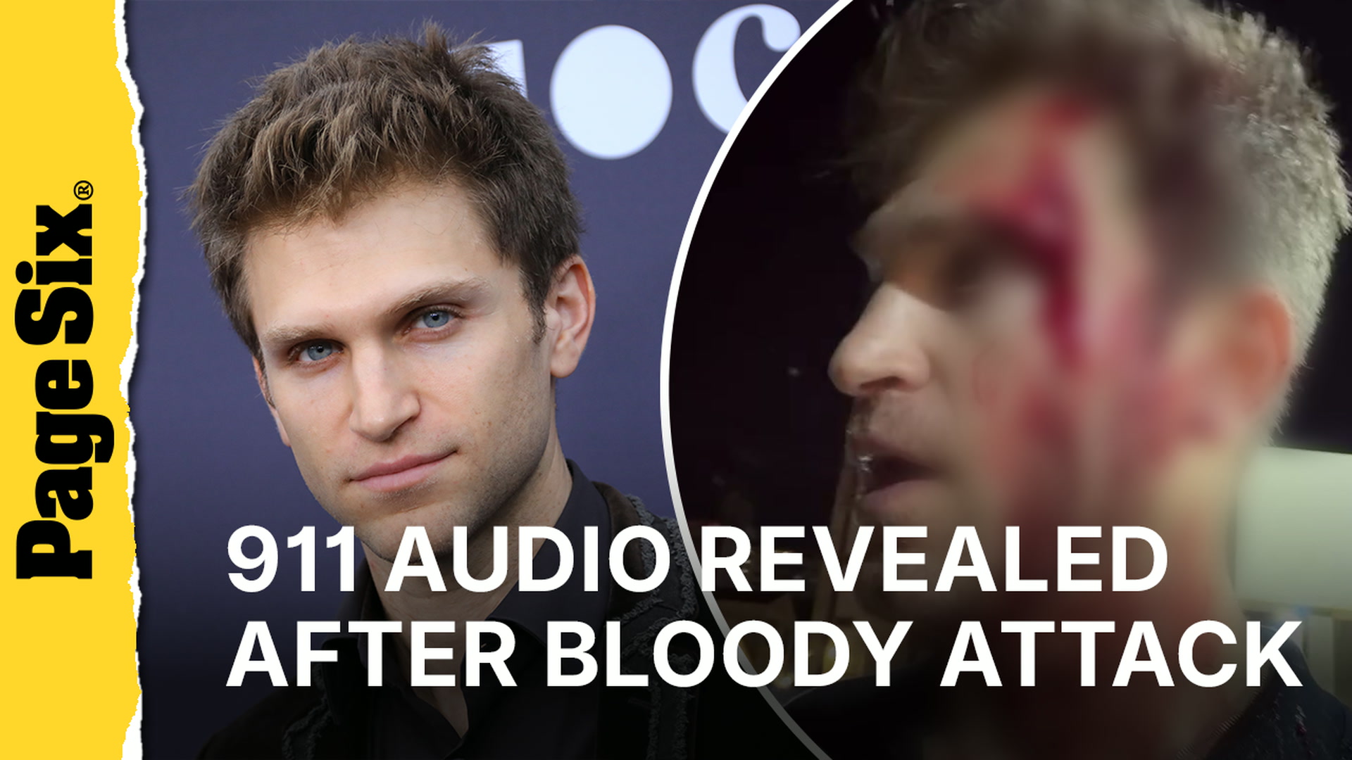 Video thumbnail for Keegan Allen 911 dispatch audio revealed after actor's bloody LA grocery store attack