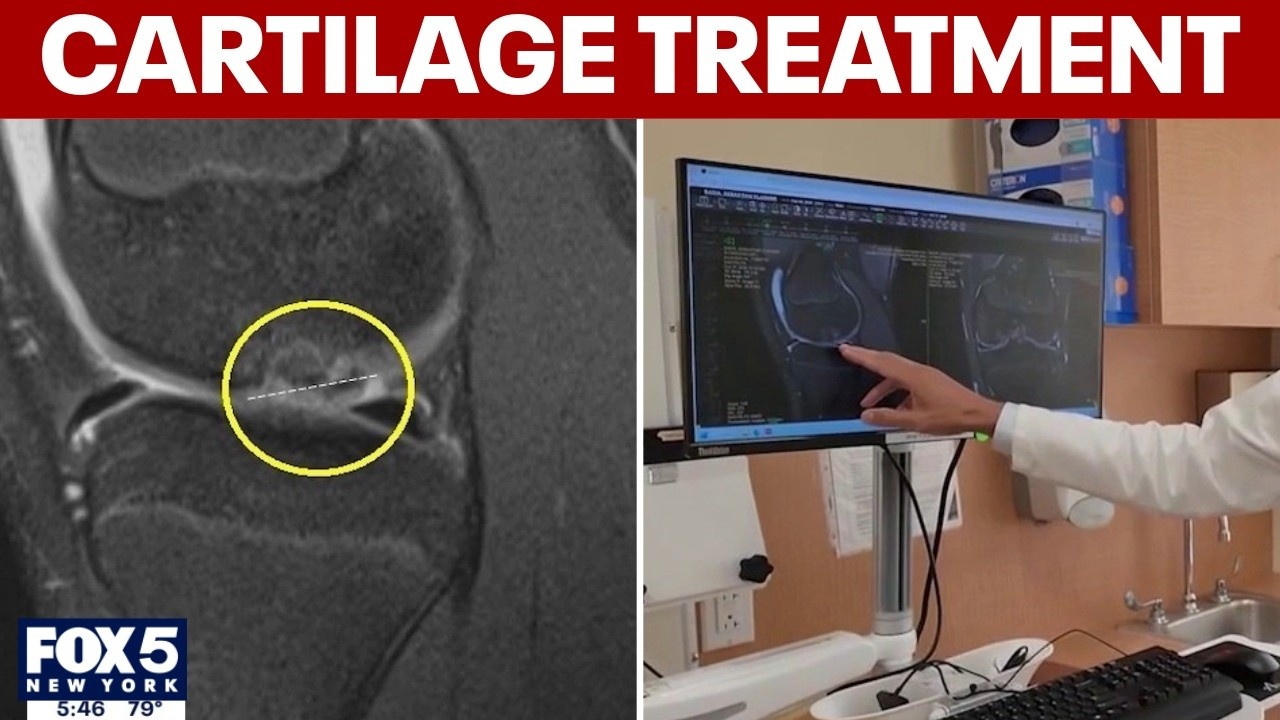 Video thumbnail for New treatment for cartilage problems
