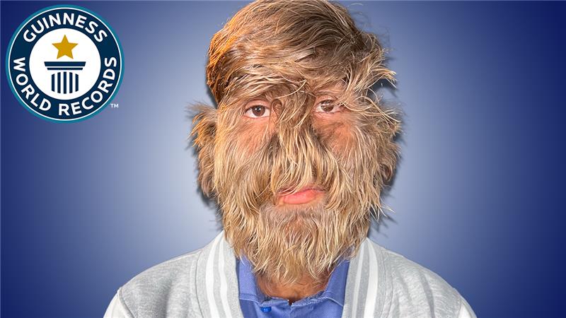 'Video thumbnail for Hairiest Face'