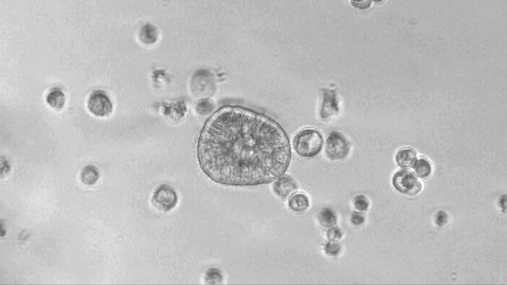 Video thumbnail for A closer look at robots built entirely from human cells