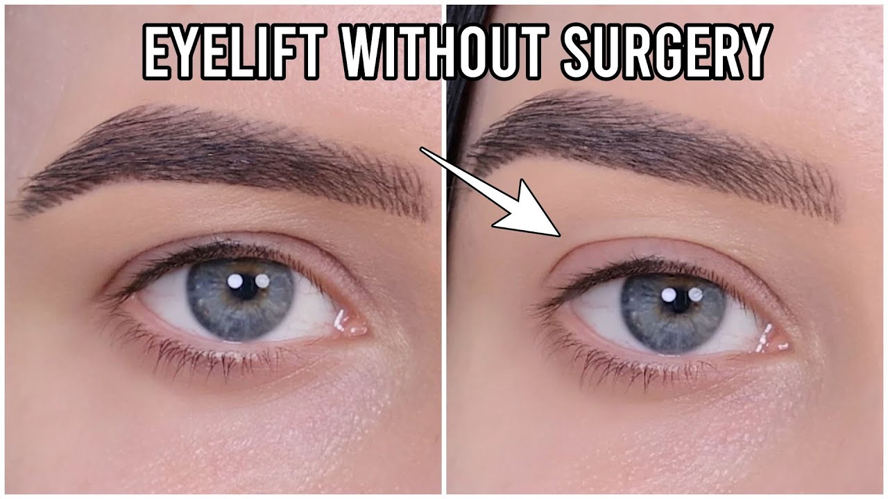 Video thumbnail for Trick to Instantly Lift Your Eyes & Brows - No Surgery or Makeup Needed!