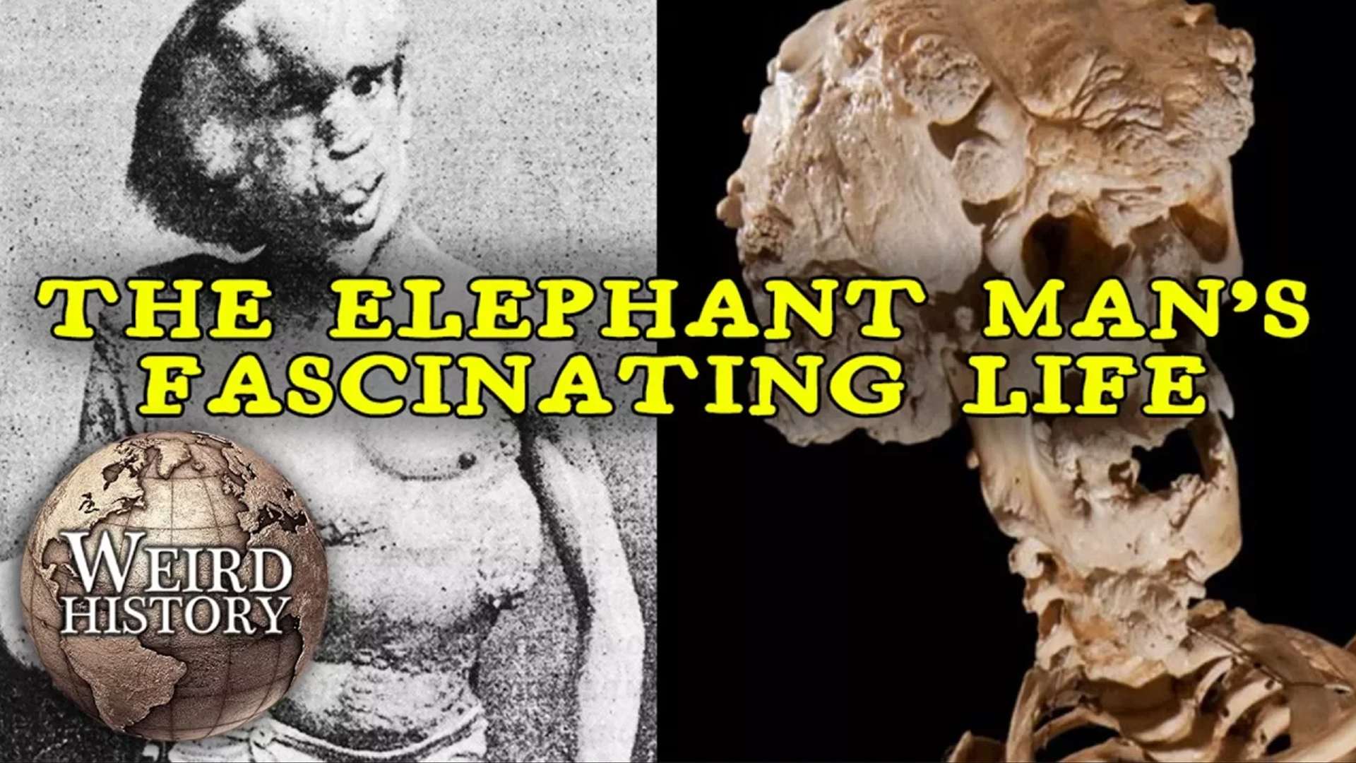 Video thumbnail for The Elephant Man | The Weird & Tragic Story of Joseph Merrick