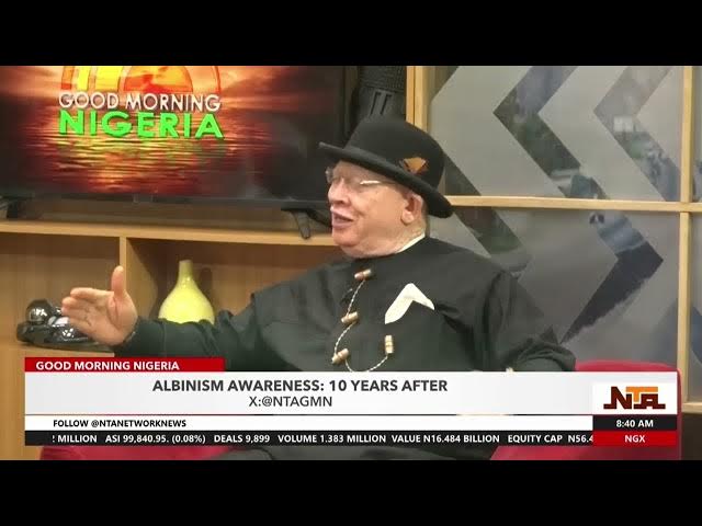 Video thumbnail for Bad Experience of Albinos Has Reduced Over The years | 5th July 2024 | NTA