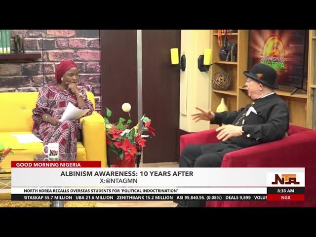 Video thumbnail for The Stigma Of Albanism Has Reduced Over The Years | 4th July 2024 | NTA