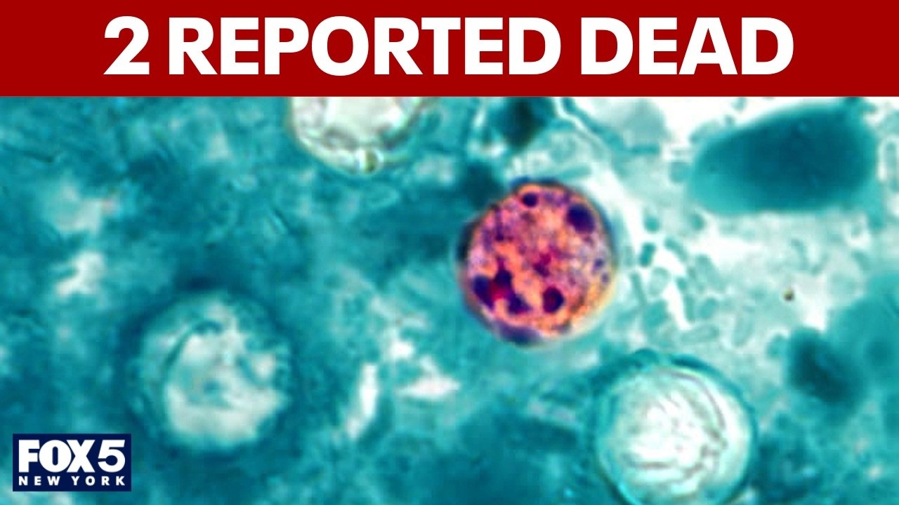 Video thumbnail for First 2 deaths related to cyclosporiasis outbreak