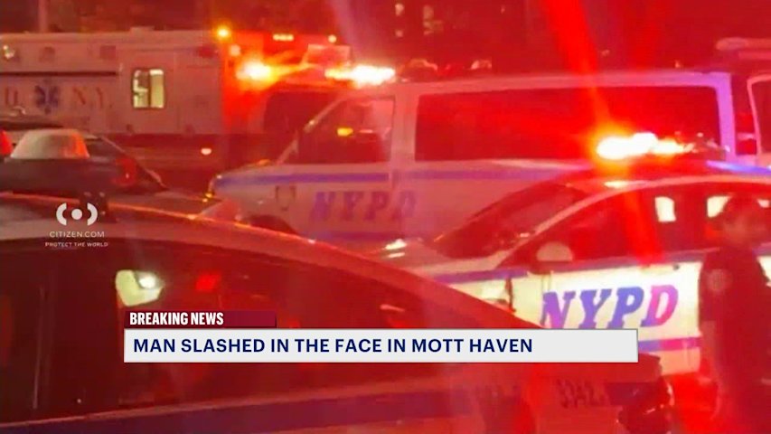 Video thumbnail for Man slashed in the face outside Mott Haven restaurant