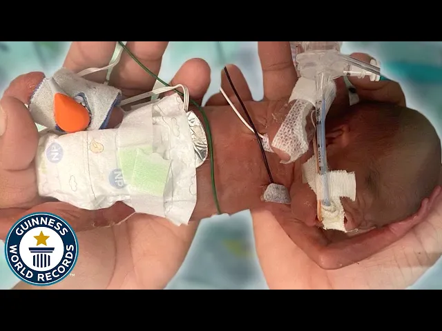 'Video thumbnail for Meet the most premature baby'