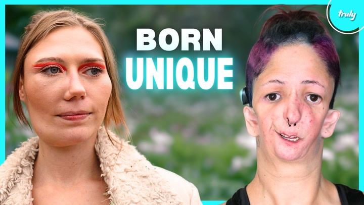 Video thumbnail for Meet 8 Of The Rarest People In The World | BORN DIFFERENT