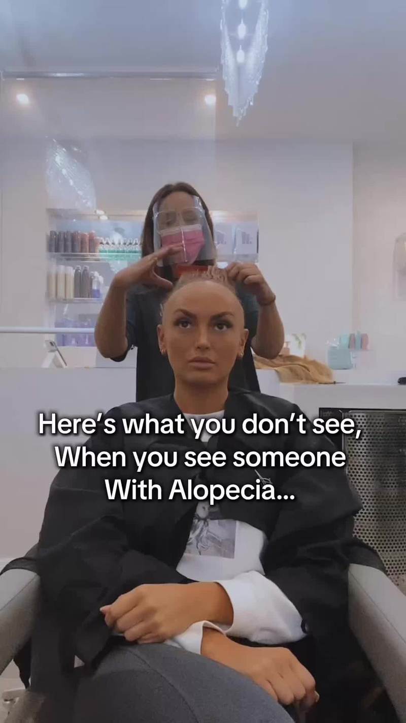 Video thumbnail for Shaving the Last Strands while Facing Alopecia Universalis