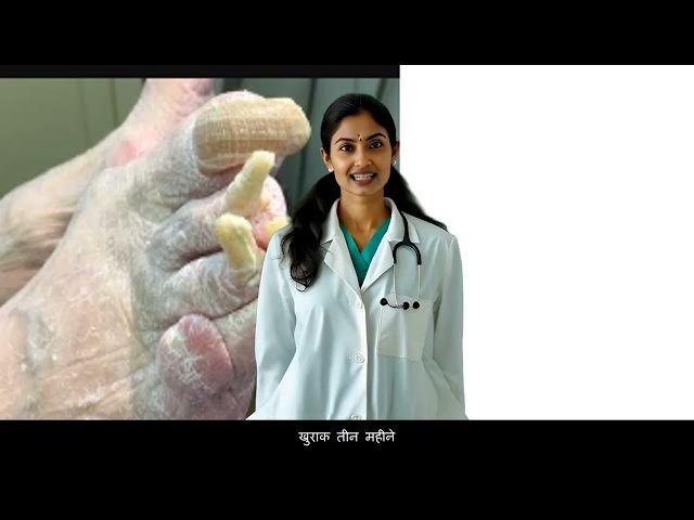 Video thumbnail for naakhoon phangas