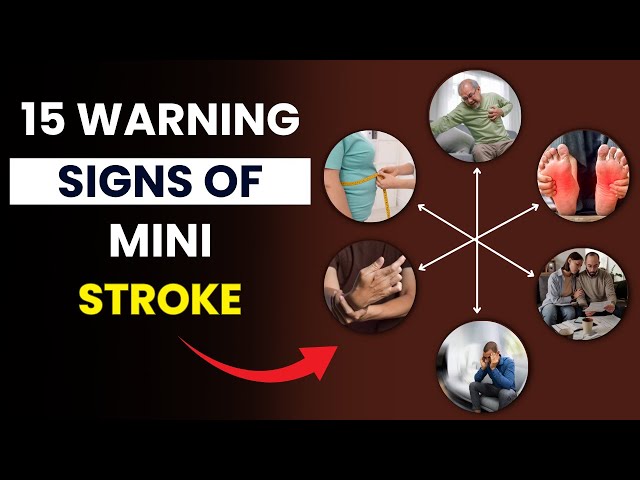 Video thumbnail for 15 Silent Warning Signs of a Mini Stroke You Should NEVER Ignore | Early Symptoms of Mini Stroke