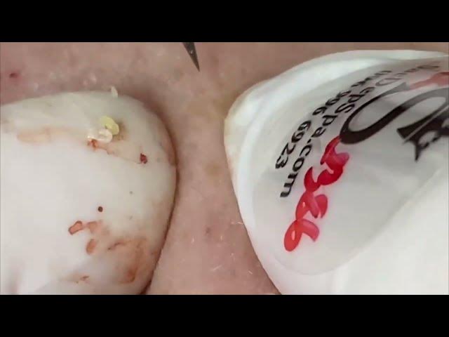 Video thumbnail for ππππππ‘ πΎπ‘πππ£π¨ππ£π Relax Every Day SacDepSpa Hours #100006