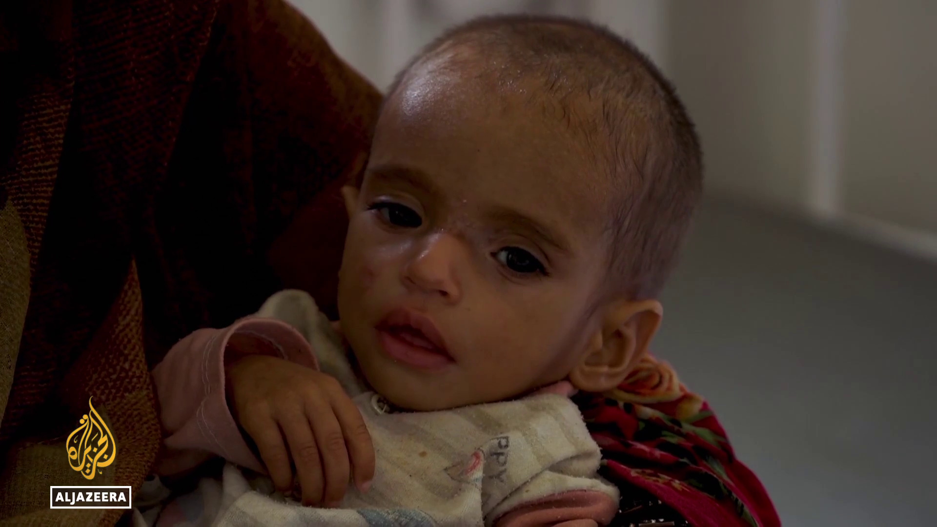 Video thumbnail for Afghanistan malnutrition: UN warns 3.7 million children are at risk