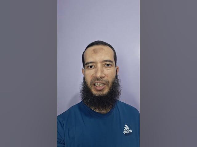Video thumbnail for بسيط بيوصيني البس النضاره والسبب