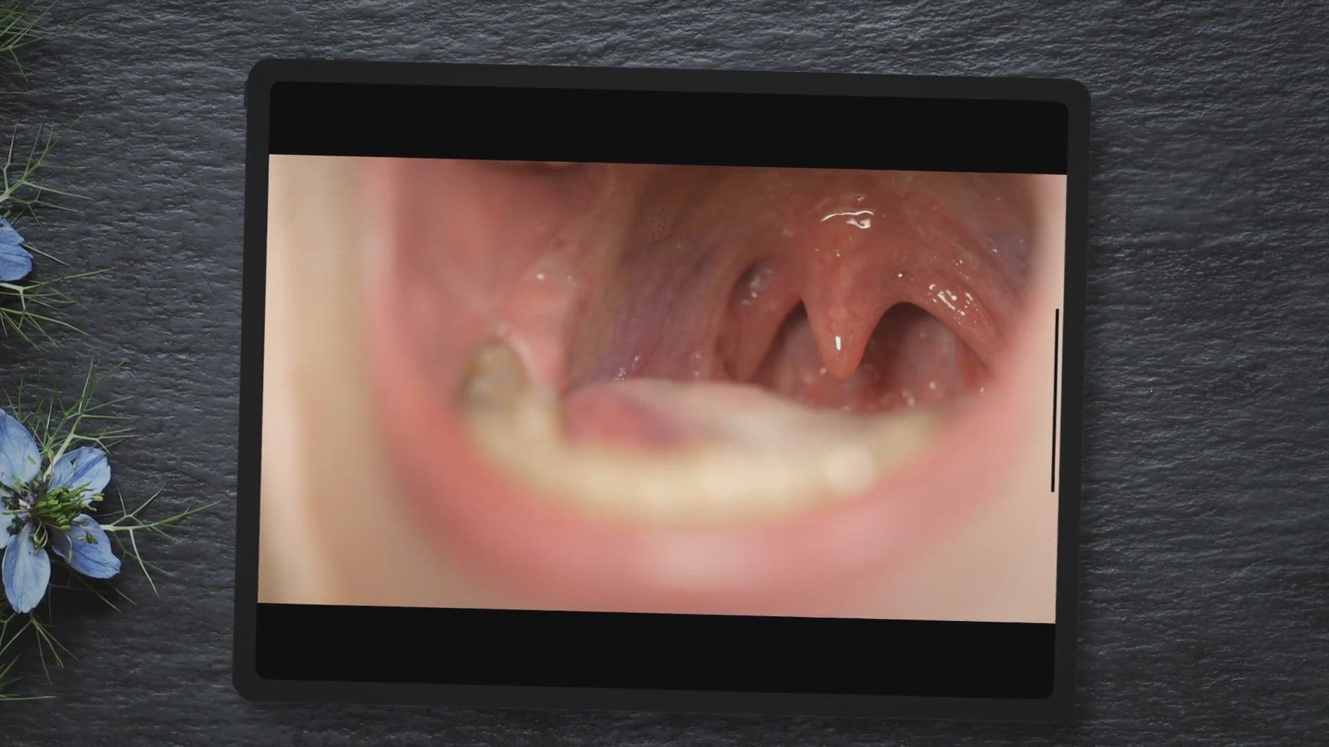 'Video thumbnail for Douleurs cervicales et gorge serrée : Quel lien ? (Explication)'