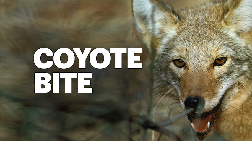 Video thumbnail for Woman hospitalized after coyote bite in Hastings-on-Hudson