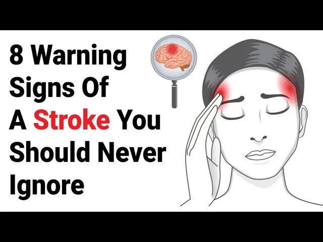 Video thumbnail for DON'T IGNORE These Early Warning Signs of Stroke ⚠🧠