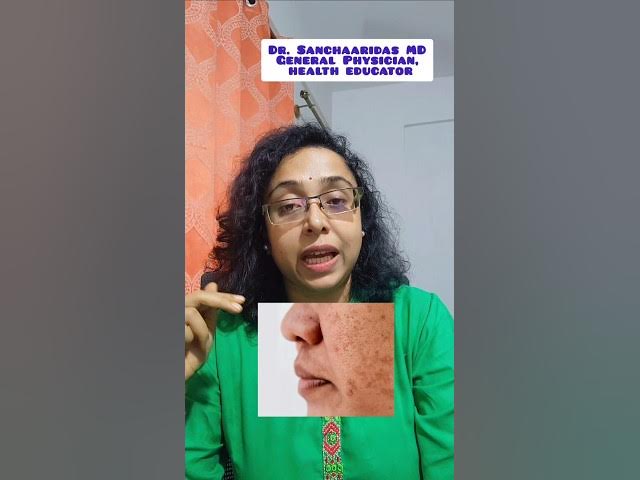 Video thumbnail for Common health problem due to nutrient deficiencies