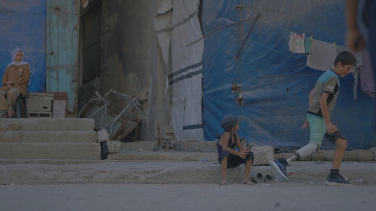 Video thumbnail for Gaza Boy Plays With Prosthesis.