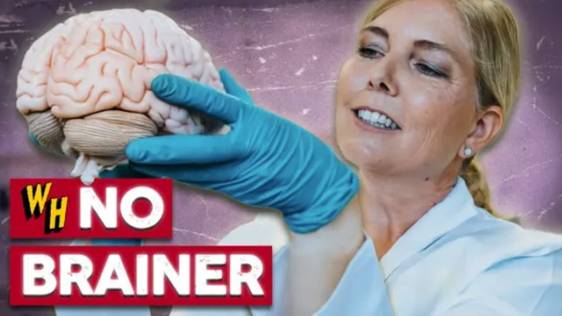 Video thumbnail for What It's Actually Like To Have A Lobotomy