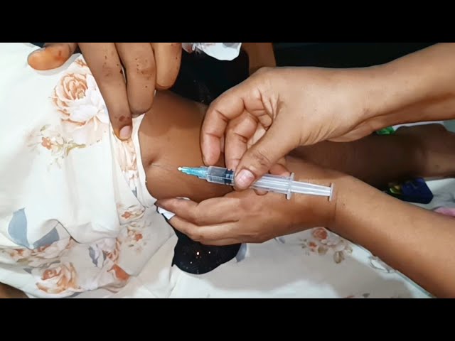 Video thumbnail for im intramuscular injection Push in the Arm.Ketorolac 30 Injection"Kflam" injection push 25 Ep 122