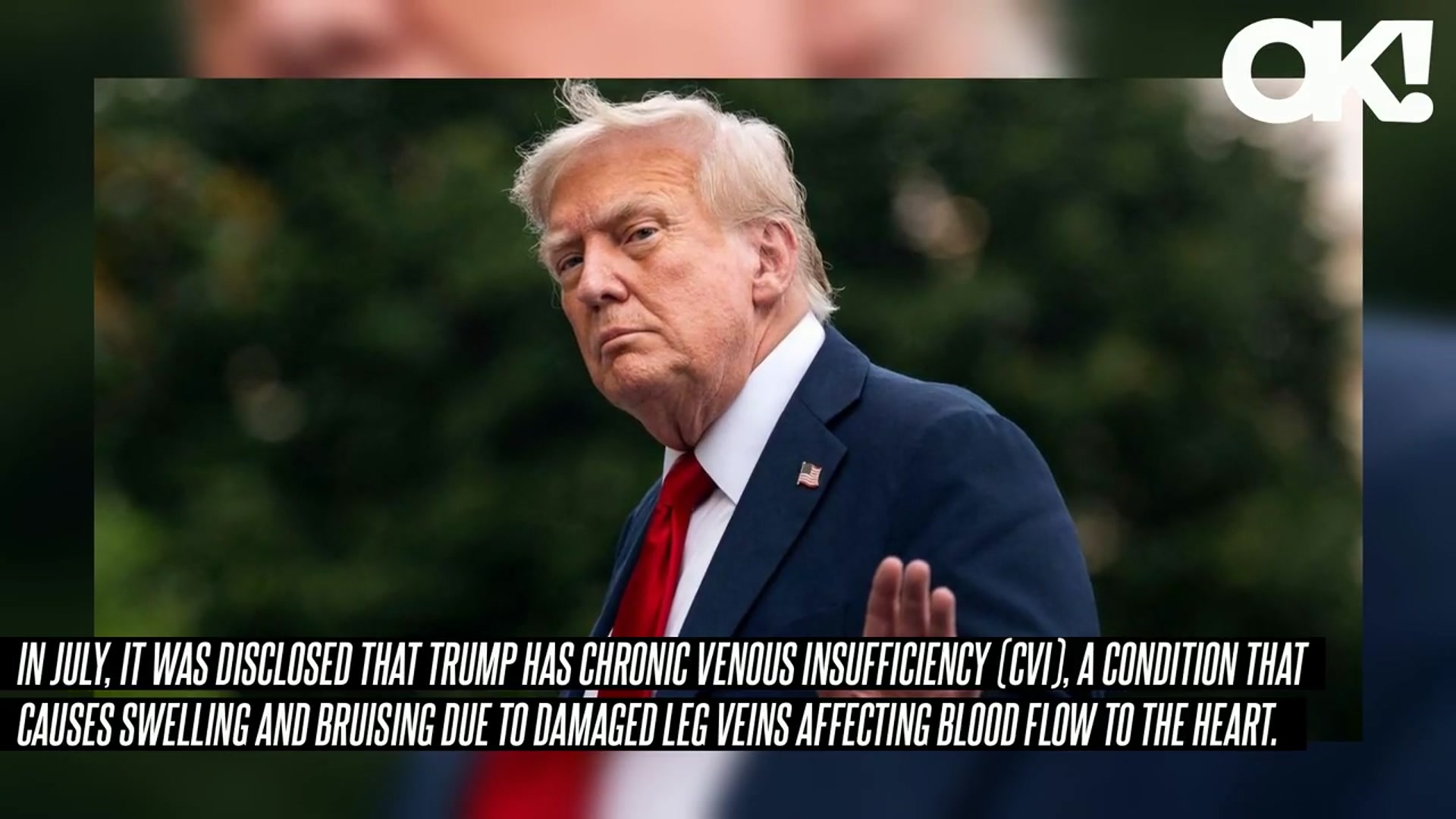 'Video thumbnail for Donald Trump's Hand Makeup Raises New Health Concerns After Cankles Cover-Up Goes Viral'
