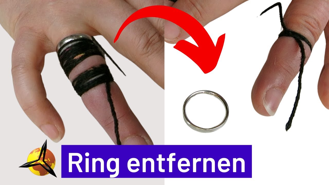 'Video thumbnail for Ring vom Finger entfernen / abziehen (Fadentrick)'
