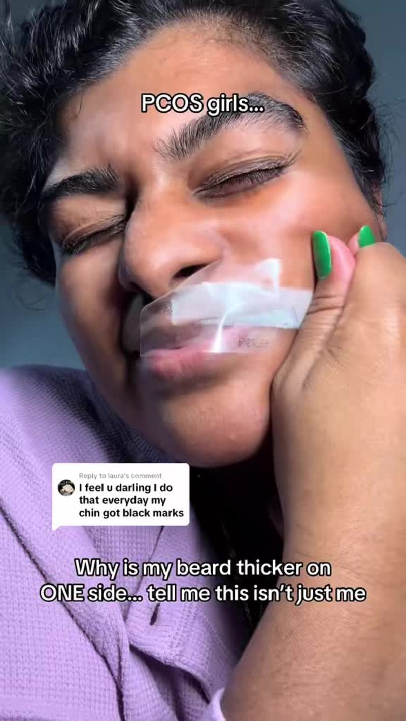 Video thumbnail for PCOS Beard Growth Struggles and Satisfying Wax Removal