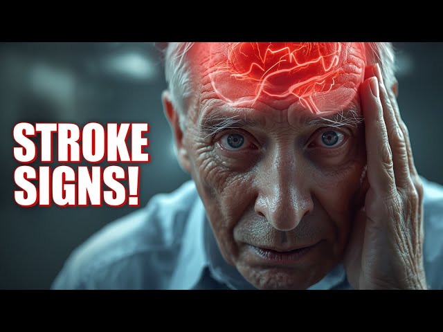 Video thumbnail for 11 Stroke Signs You Must Know (Doctors Say These Seconds Save Lives) | Symptoms of Stroke