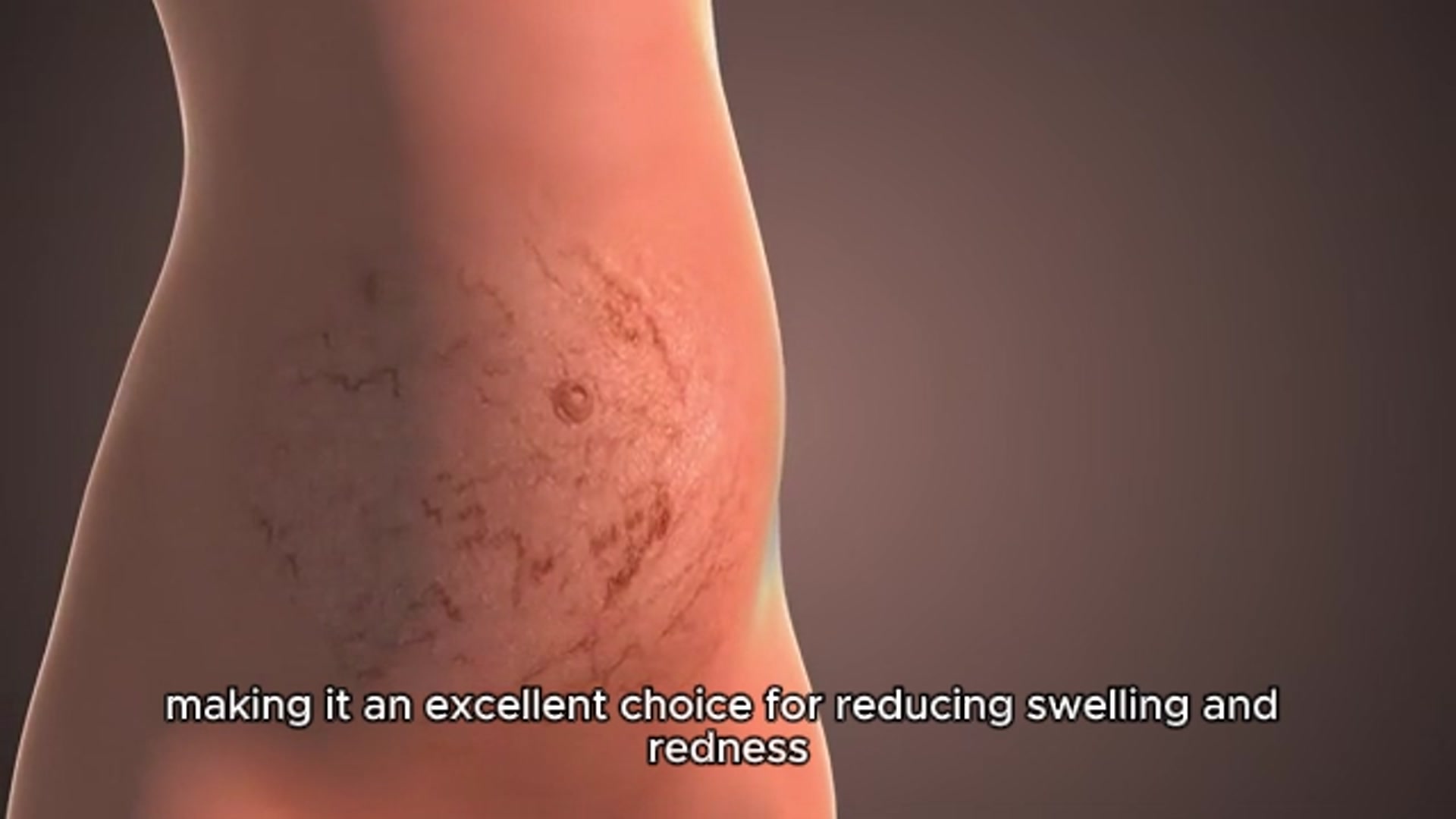 Video thumbnail for Helichrysum Oil benefits