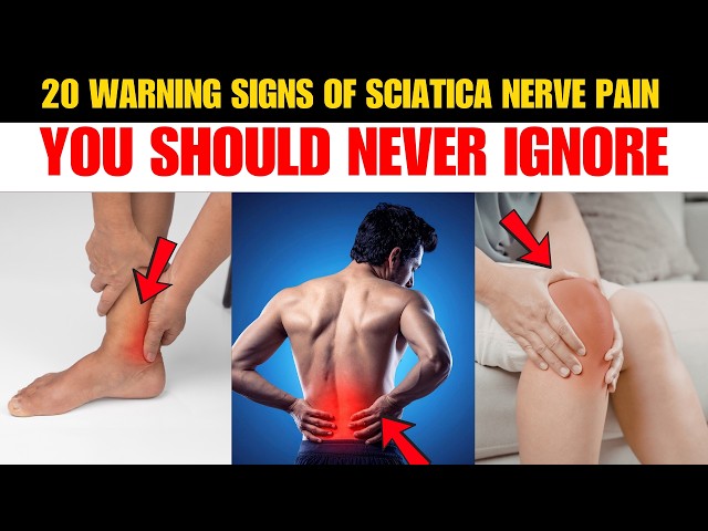 Video thumbnail for 20 Warning Signs of SCIATICA NERVE PAIN You Should NEVER Ignore