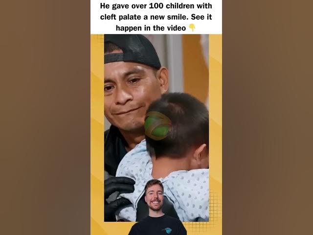 Video thumbnail for He gave over 100 children with cleft palate a new smile. See it happen in the video 👇