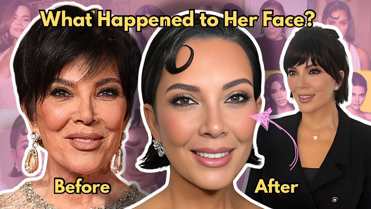 Video thumbnail for Kris Jenner’s Uncanny Facelift & the Dystopian Future of Aging