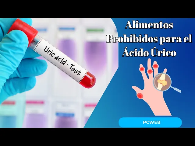 'Video thumbnail for Alimentos Prohibidos para el Ácido Úrico Alto o la Gota: 9 Opciones a Evitar'